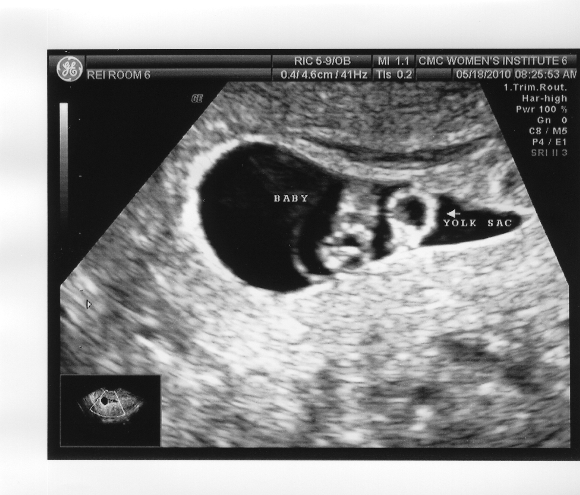 fetus.jpg